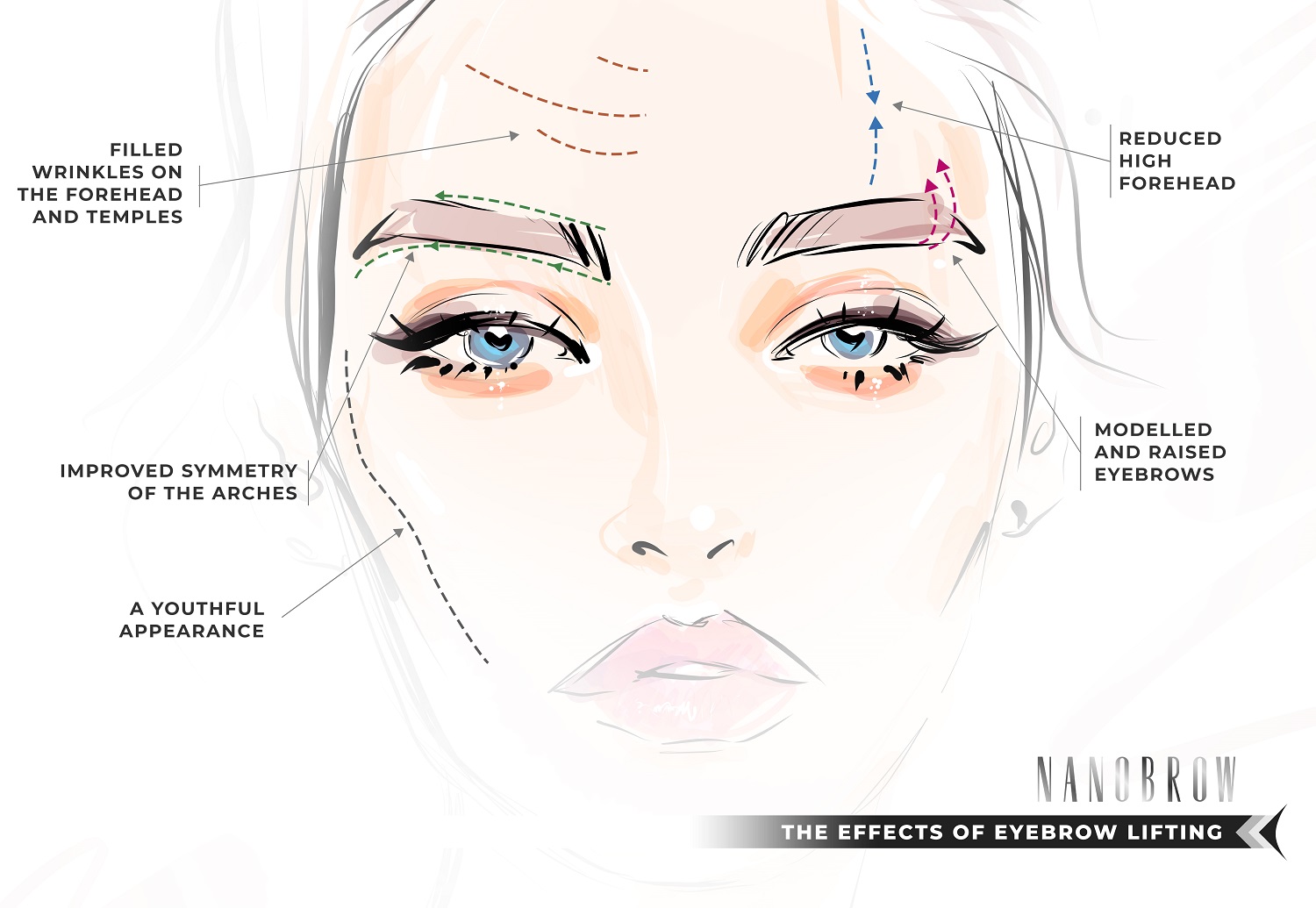 What causes brow lift?